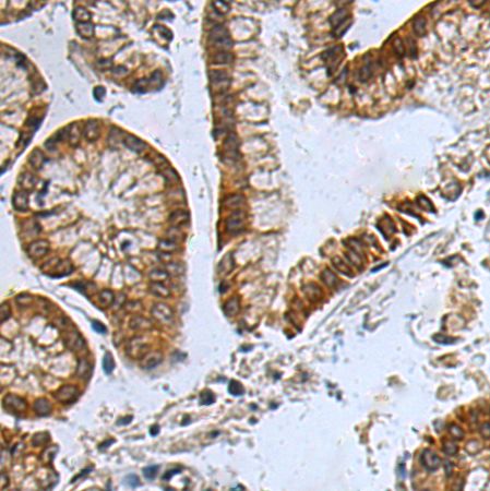 兔抗APCDD1多克隆抗体