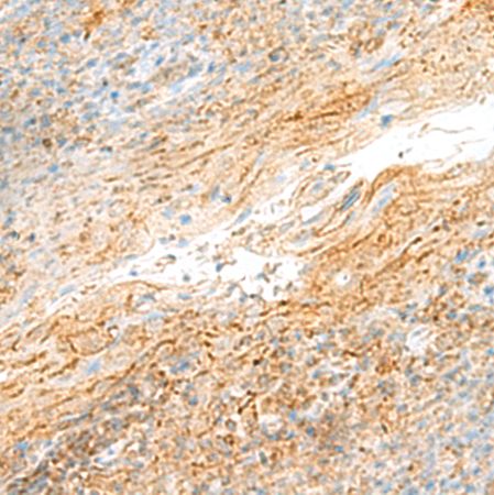 兔抗MRPS18B多克隆抗体