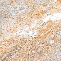 兔抗MRPS18B多克隆抗体