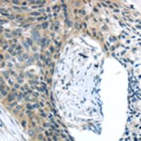 兔抗KIT多克隆抗