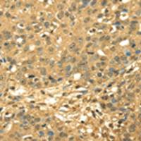 兔抗RPA2多克隆抗体