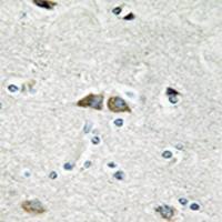 兔抗RPL39L多克隆抗体