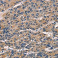 兔抗SENP1多克隆抗体