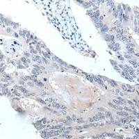 兔抗VPS35多克隆抗体