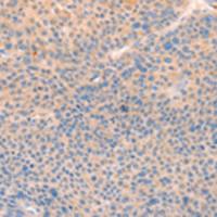 兔抗CD109多克隆抗体