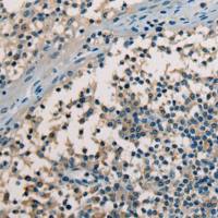 兔抗CHODL多克隆抗体