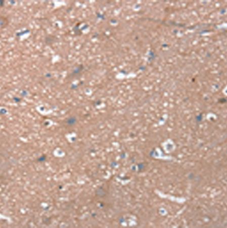 兔抗RHEB多克隆抗体