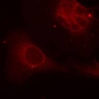 兔抗SHC1 (Phospho-Tyr349)多克隆抗体