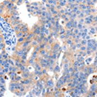 兔抗MAPK10多克隆抗体