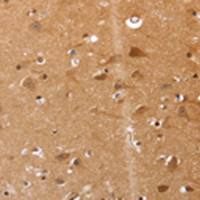 兔抗SELENOS多克隆抗体