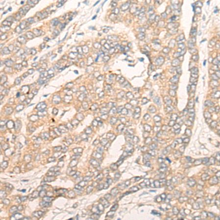 兔抗DALRD3多克隆抗体