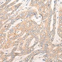 兔抗DALRD3多克隆抗体