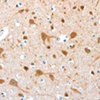 兔抗AEBP2多克隆抗体