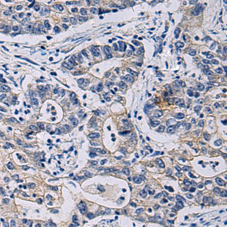 兔抗CHST3多克隆抗体