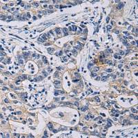 兔抗CHST3多克隆抗体