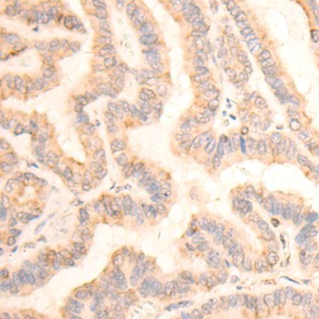 兔抗TUBA1B多克隆抗体