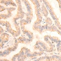 兔抗TUBA1B多克隆抗体