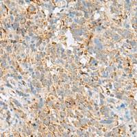 兔抗VDAC3多克隆抗体