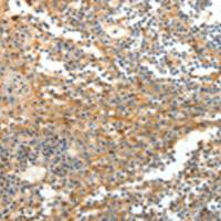 兔抗DTX3多克隆抗体