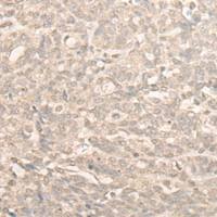 兔抗NUBP2多克隆抗体