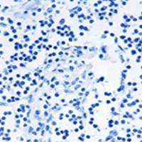 兔抗PGLS多克隆抗体