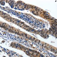 兔抗BCL2多克隆抗体