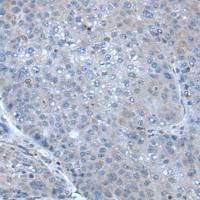 兔抗SCGB3A1多克隆抗体