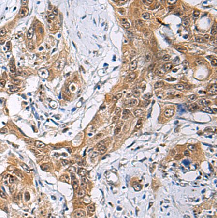兔抗THOC3多克隆抗体