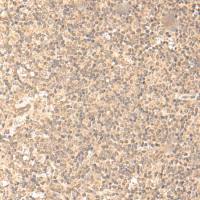 兔抗FOXO4多克隆抗体