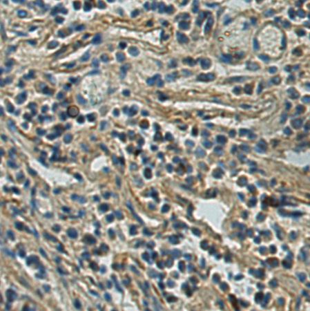 兔抗TNFRSF10A多克隆抗体
