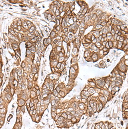 兔抗RNF111多克隆抗体