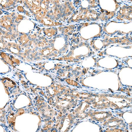 兔抗RPL35A多克隆抗体