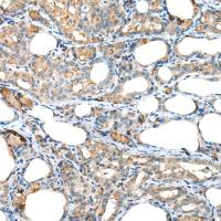 兔抗RPL35A多克隆抗体