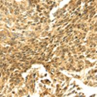 兔抗SHPRH多克隆抗体