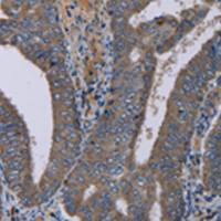 兔抗NECTIN4多克隆抗体