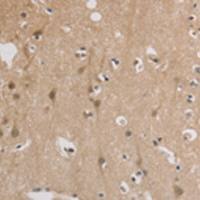 兔抗ELOVL1多克隆抗体