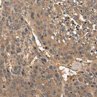 兔抗COL25A1多克隆抗体