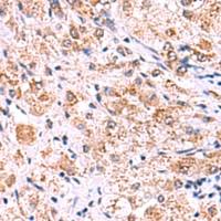 兔抗ECSIT多克隆抗体