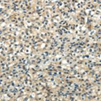 兔抗WNT2多克隆抗体