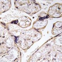 兔抗ACER3多克隆抗体