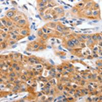 兔抗YWHAG多克隆抗体