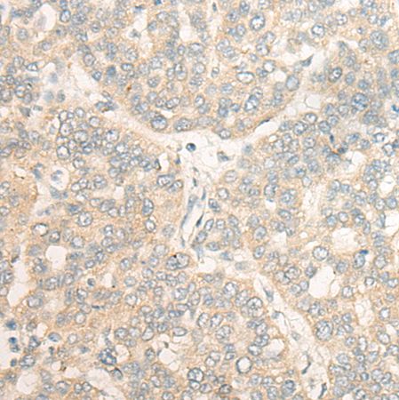 兔抗CPVL多克隆抗体