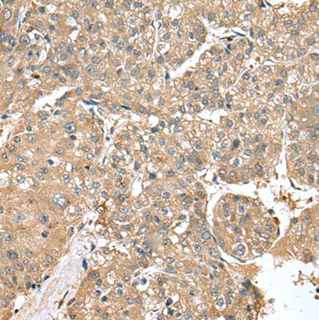 兔抗UBE2Z多克隆抗体