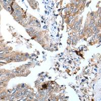 兔抗GKN1多克隆抗体