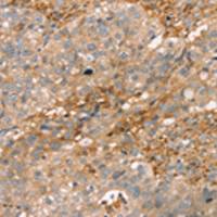 兔抗ROBO3多克隆抗体