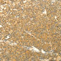 兔抗AARS2多克隆抗体