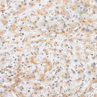 兔抗SYCE3多克隆抗体