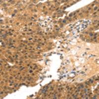 兔抗MED14多克隆抗体