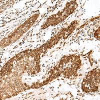 兔抗FANCB多克隆抗体