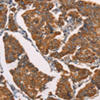 兔抗SPR多克隆抗体